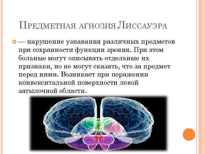 Вид агнозии характеризующийся нарушением узнавания предметов или их изображений