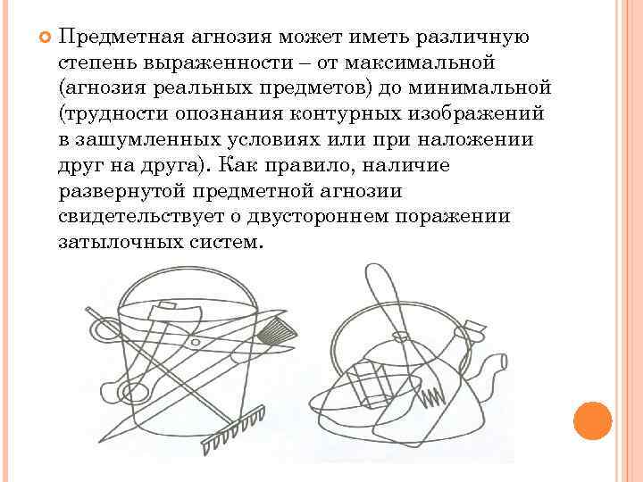  Предметная агнозия может иметь различную степень выраженности – от максимальной (агнозия реальных предметов)