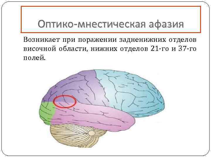 При какой афазии