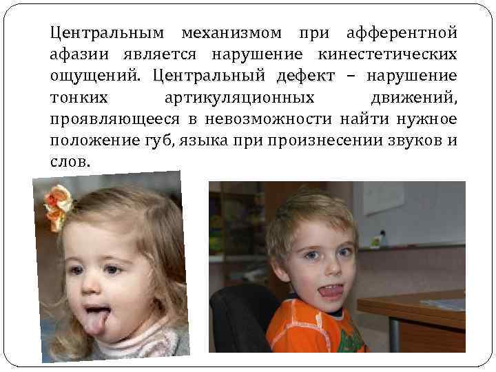 Центральным механизмом при афферентной афазии является нарушение кинестетических ощущений. Центральный дефект – нарушение тонких