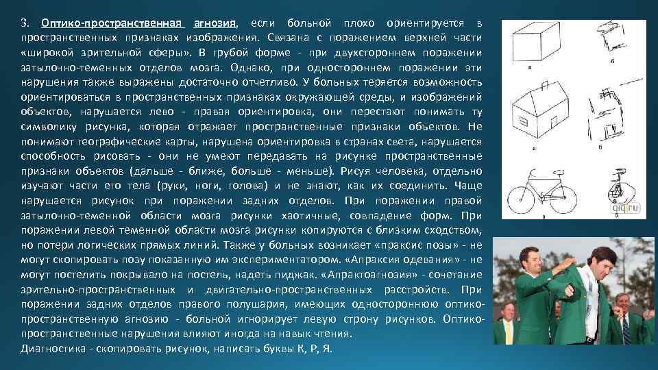 3. Оптико-пространственная агнозия, если больной плохо ориентируется в пространственных признаках изображения. Связана с поражением