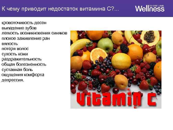 К чему приводит недостаток витамина С? . . . кровоточивость десен выпадение зубов легкость