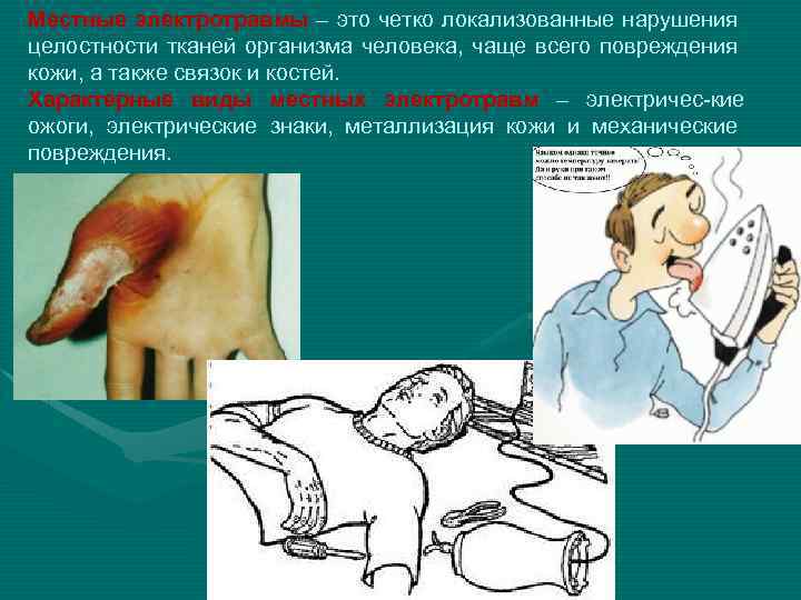 Местные электротравмы – это четко локализованные нарушения целостности тканей организма человека, чаще всего повреждения