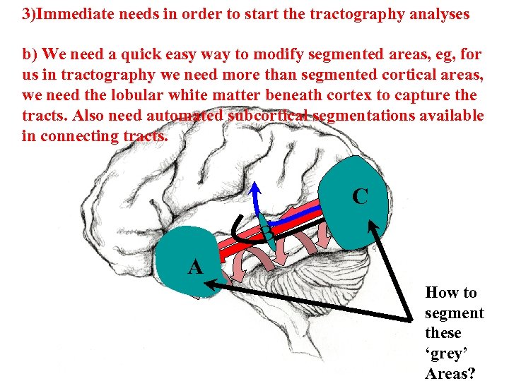 3)Immediate needs in order to start the tractography analyses b) We need a quick