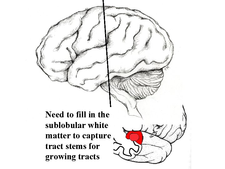 Need to fill in the sublobular white matter to capture tract stems for growing