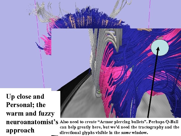 Up close and Personal; the warm and fuzzy neuroanatomist’s Also need to create “Armor