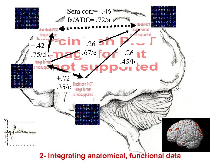 Sem corr= -. 46 fa/ADC=. 72/a +. 26. 67/e +. 42. 75/d +. 26.