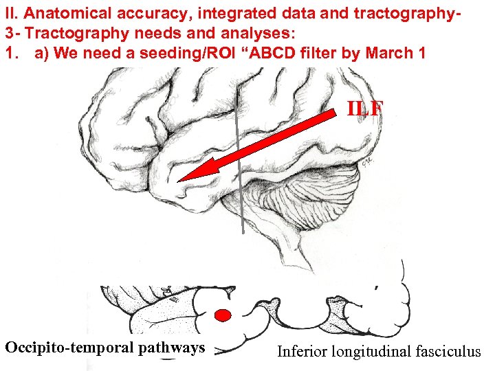II. Anatomical accuracy, integrated data and tractography 3 - Tractography needs and analyses: 1.