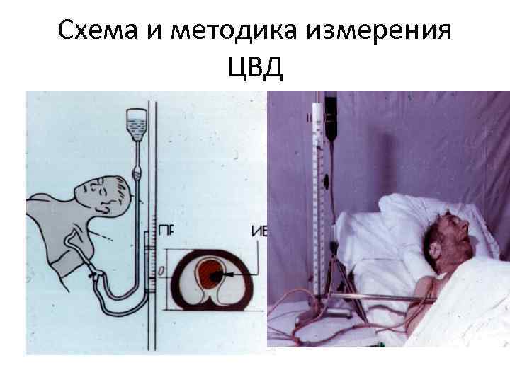 Схема и методика измерения ЦВД 