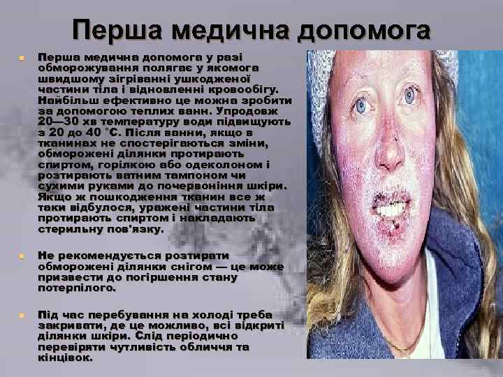 Перша медична допомога n n n Перша медична допомога у разі обморожування полягає у