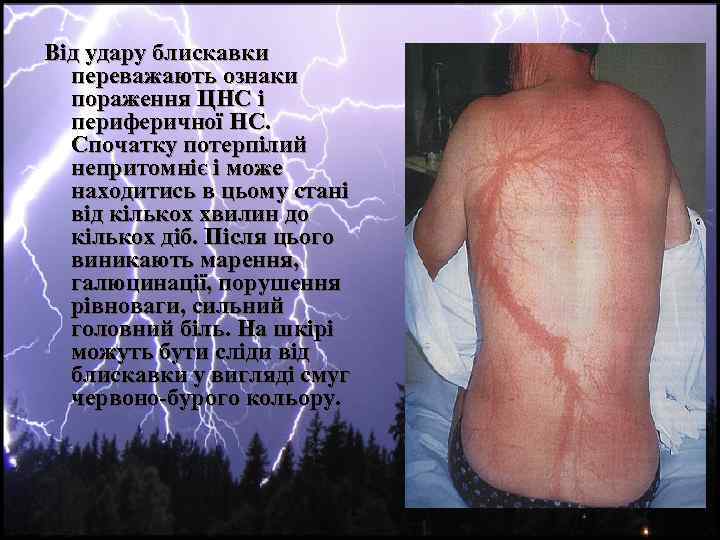 Від удару блискавки переважають ознаки пораження ЦНС і периферичної НС. Спочатку потерпілий непритомніє і