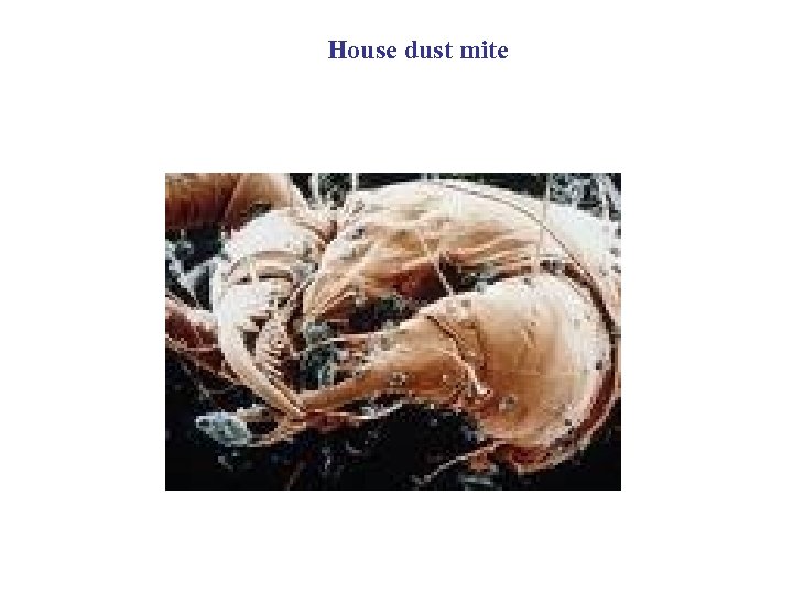 House dust mite 