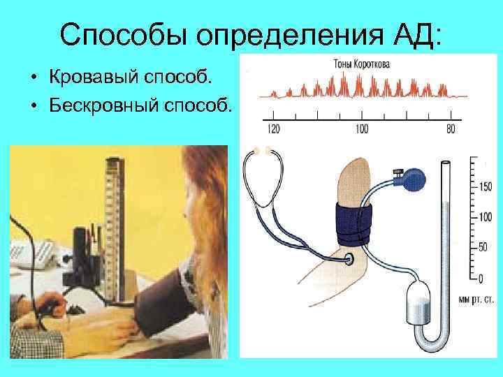 Способы определения АД: • Кровавый способ. • Бескровный способ. 