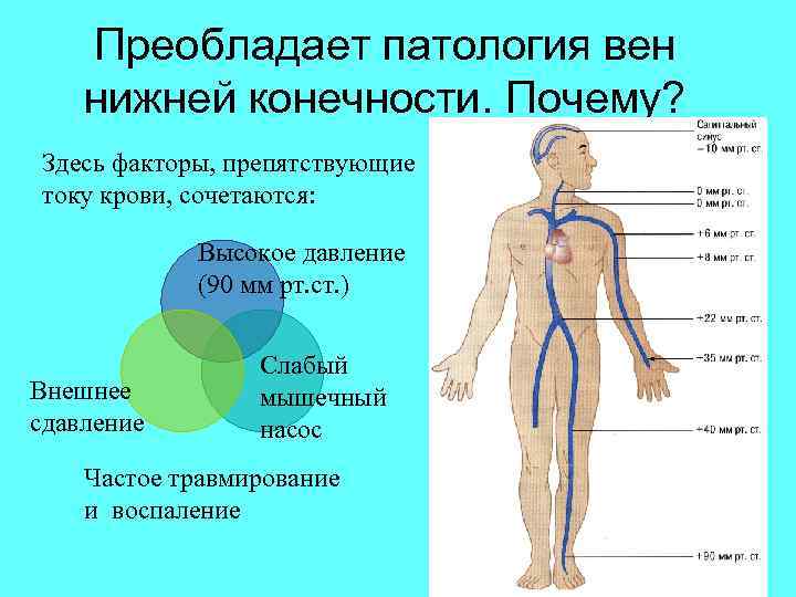 Преобладает патология вен нижней конечности. Почему? Здесь факторы, препятствующие току крови, сочетаются: Высокое давление