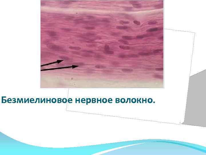 Безмиелиновое нервное волокно. 