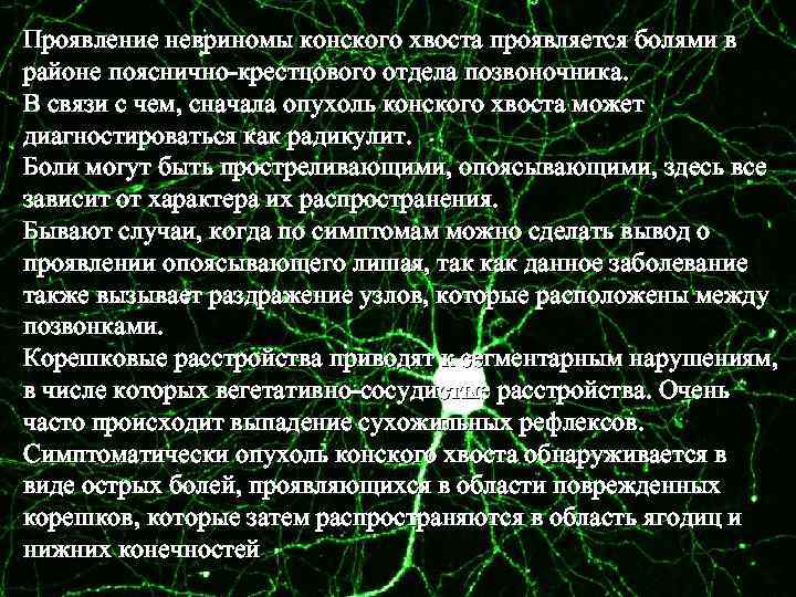 Проявление невриномы конского хвоста проявляется болями в районе пояснично-крестцового отдела позвоночника. В связи с