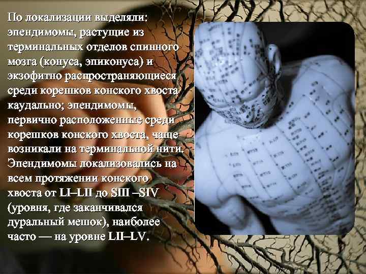 По локализации выделяли: эпендимомы, растущие из терминальных отделов спинного мозга (конуса, эпиконуса) и экзофитно