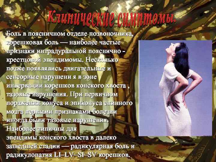 Боль в поясничном отделе позвоночника, корешковая боль — наиболее частые признаки интрадуральной пояснично крестцовой