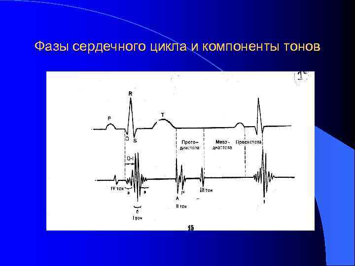 Фазы сердечного цикла и компоненты тонов 