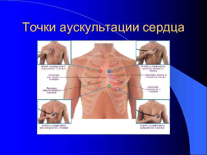 Точки аускультации сердца 