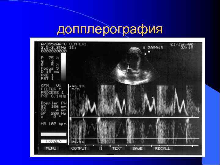 допплерография 