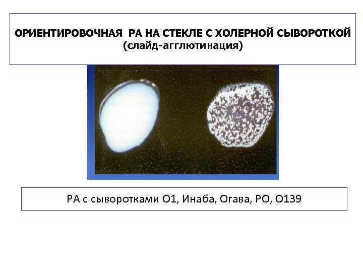 ОРИЕНТИРОВОЧНАЯ РА НА СТЕКЛЕ С ХОЛЕРНОЙ СЫВОРОТКОЙ (слайд-агглютинация) РА с сыворотками О 1, Инаба,