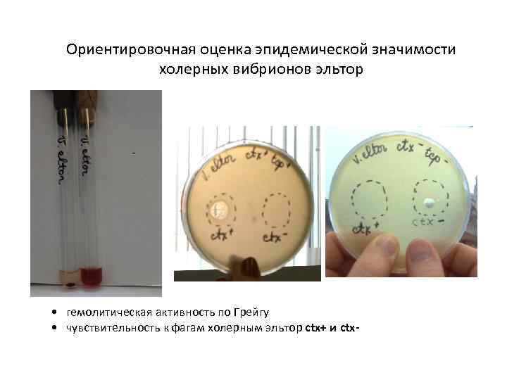 Ориентировочная оценка эпидемической значимости холерных вибрионов эльтор - • гемолитическая активность по Грейгу •