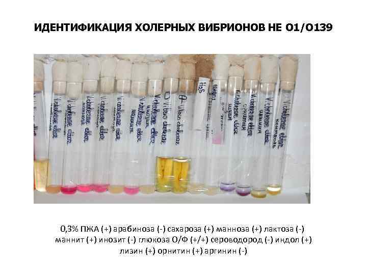 ИДЕНТИФИКАЦИЯ ХОЛЕРНЫХ ВИБРИОНОВ НЕ О 1/О 139 0, 3% ПЖА (+) арабиноза (-) сахароза