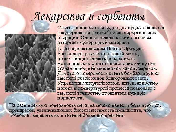 Лекарства и сорбенты Стент - эндопротез сосудов для предотвращения закупоривания артерий после хирургических операций.
