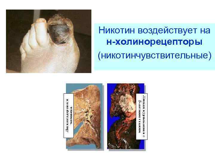 Никотин воздействует на н-холинорецепторы (никотинчувствительные) 