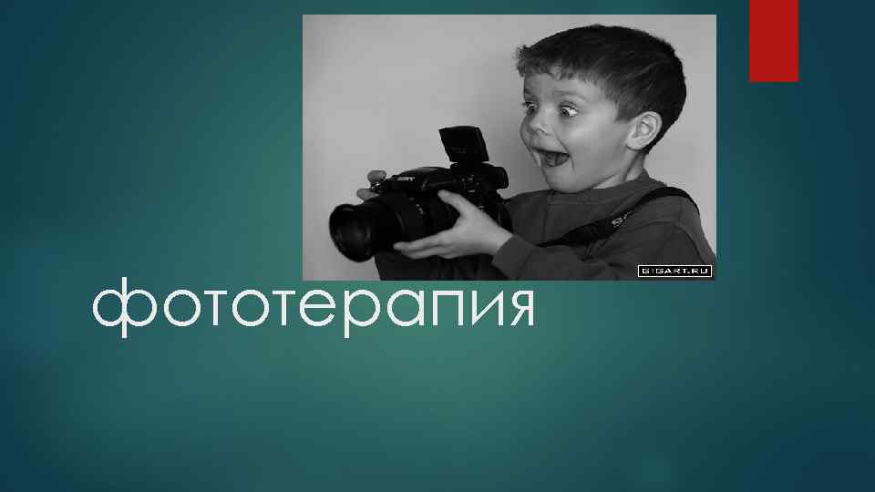 фототерапия 