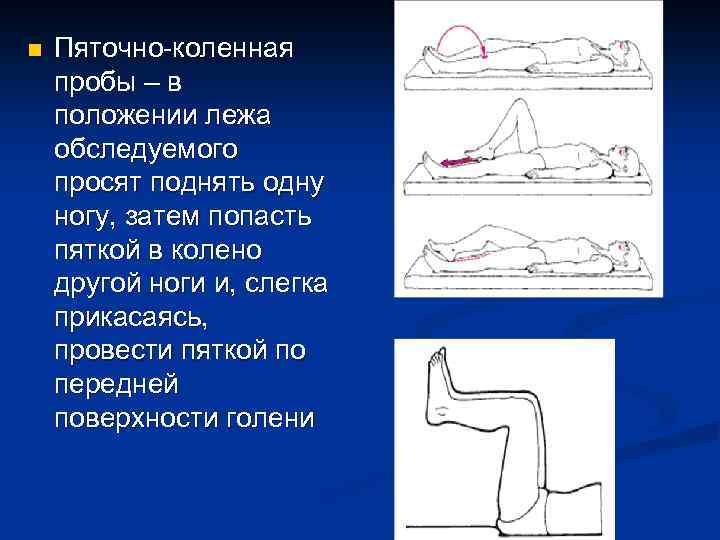 n Пяточно-коленная пробы – в положении лежа обследуемого просят поднять одну ногу, затем попасть