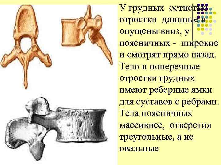 l У грудных остистые отростки длинные и опущены вниз, у поясничных - широкие и