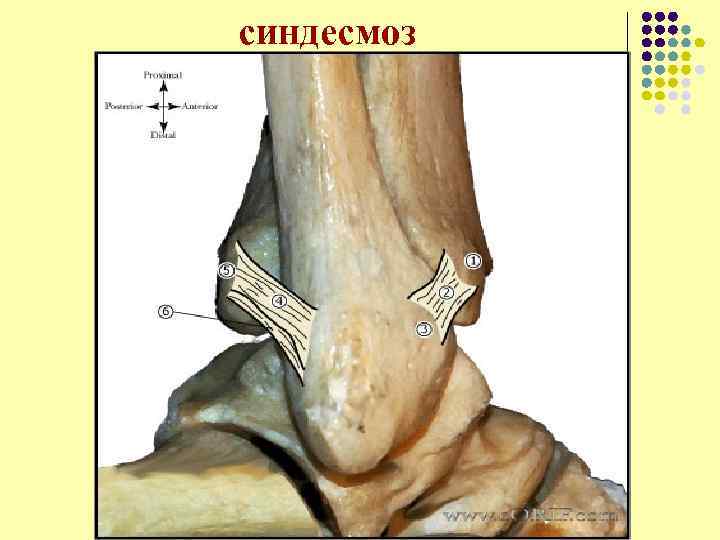 синдесмоз 