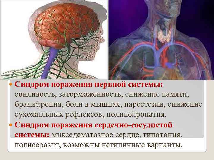Синдром поражения нервной системы: сонливость, заторможенность, снижение памяти, брадифрения, боли в мышцах, парестезии, снижение