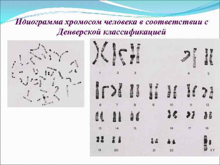 Идиограмма хромосом человека в соответствии с Денверской классификацией 