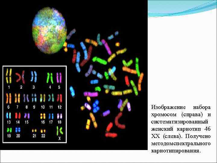 Кариотип 46 хх. Результат кариотипа: 46,ХХ. Кариотип 46. Кариотип набор хромосом. Систематизированный кариотип это.