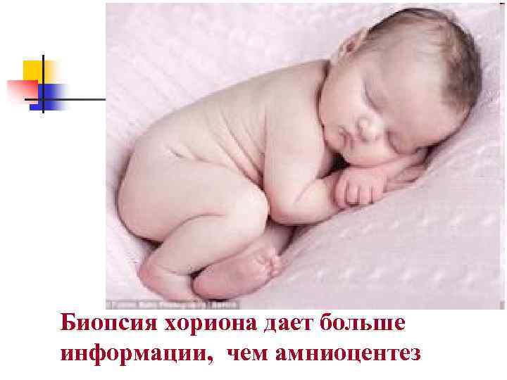 Биопсия хориона дает больше информации, чем амниоцентез 