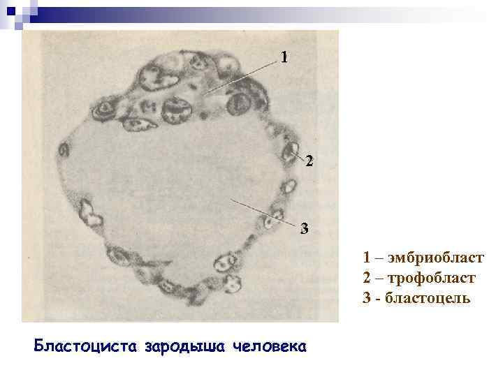 1 2 3 1 – эмбриобласт 2 – трофобласт 3 - бластоцель Бластоциста зародыша