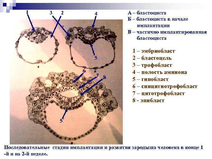1 3 2 4 5 6 7 8 А – бластоциста Б – бластоциста