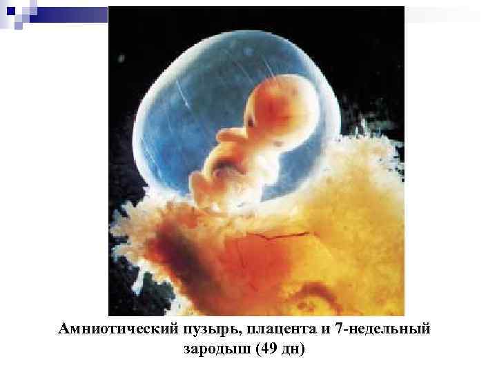 Амниотический пузырь, плацента и 7 -недельный зародыш (49 дн) 
