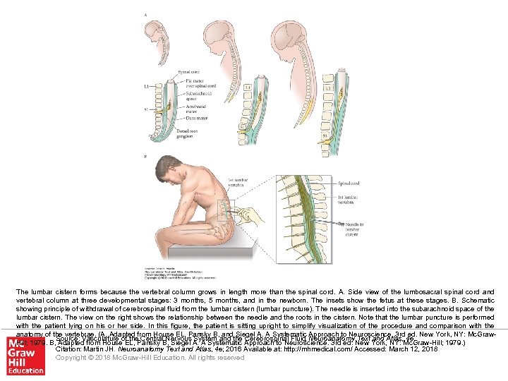 The lumbar cistern forms because the vertebral column grows in length more than the
