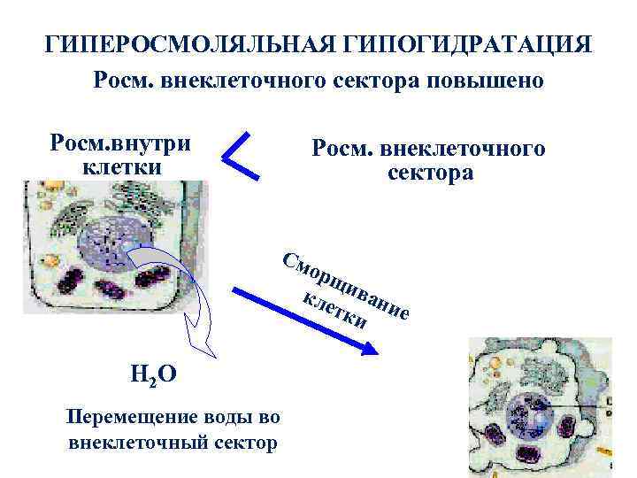 ГИПЕРОСМОЛЯЛЬНАЯ ГИПОГИДРАТАЦИЯ Росм. внеклеточного сектора повышено Росм. внутри клетки Росм. См внеклеточного сектора орщ