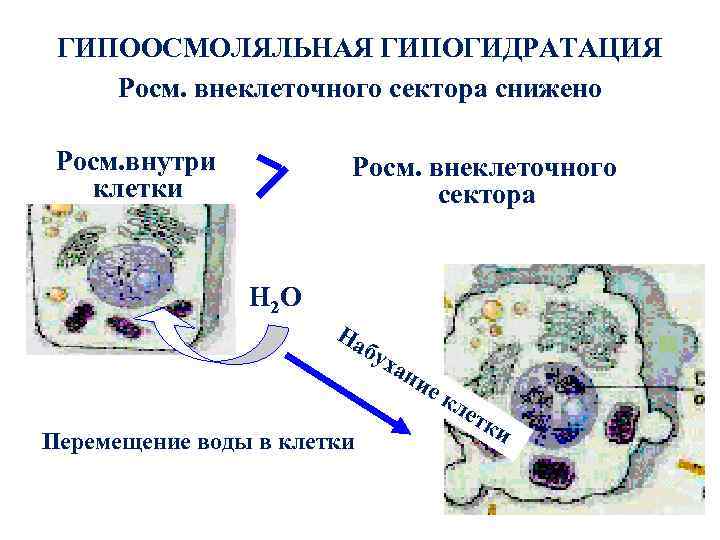 ГИПООСМОЛЯЛЬНАЯ ГИПОГИДРАТАЦИЯ Росм. внеклеточного сектора снижено Росм. внутри Росм. клетки внеклеточного сектора Н 2