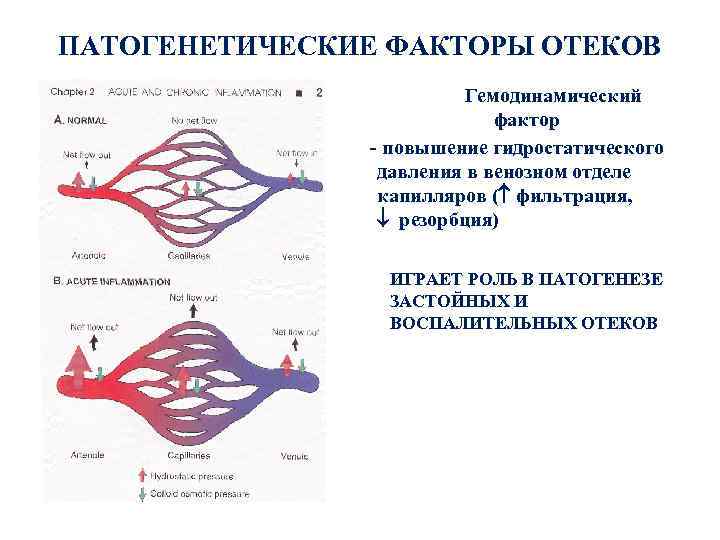 ПАТОГЕНЕТИЧЕСКИЕ ФАКТОРЫ ОТЕКОВ Гемодинамический фактор - повышение гидростатического давления в венозном отделе капилляров (