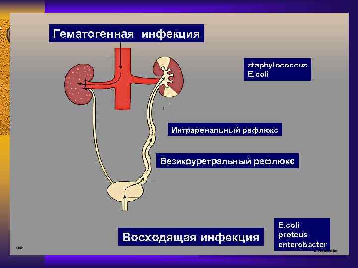 Гематогенная инфекция staphylococcus E. coli Интраренальный рефлюкс Везикоуретральный рефлюкс Восходящая инфекция E. coli proteus