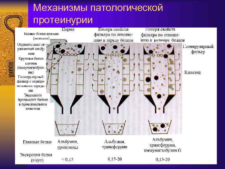 Механизмы патологической протеинурии 