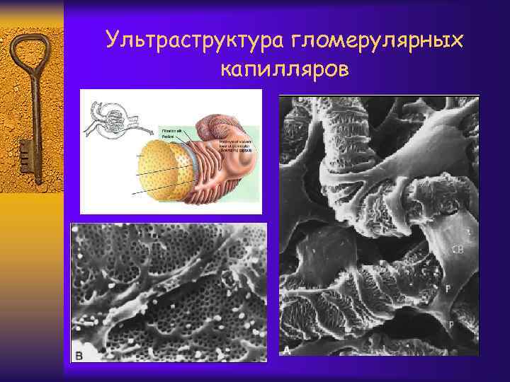 Ультраструктура гломерулярных капилляров 