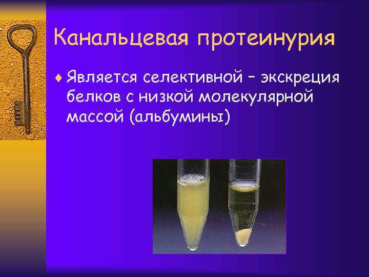 Канальцевая протеинурия ¨ Является селективной – экскреция белков с низкой молекулярной массой (альбумины) 