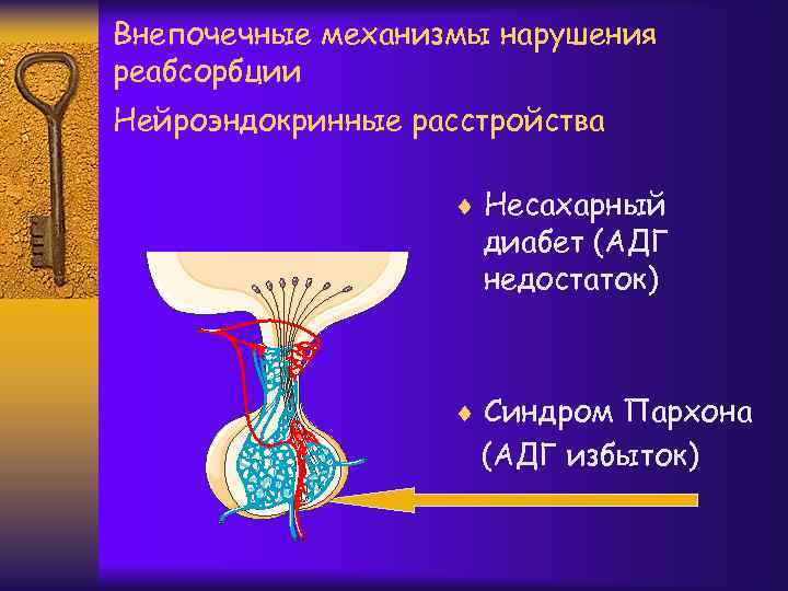 Внепочечные механизмы нарушения реабсорбции Нейроэндокринные расстройства ¨ Несахарный диабет (АДГ недостаток) ¨ Синдром Пархона